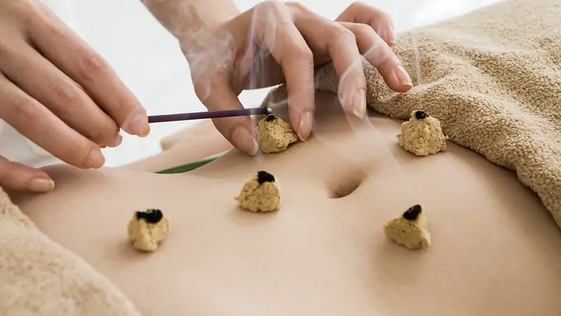moxibustion tratamiento min